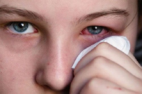 TOP 4 bệnh nguy hiểm về mắt cần điều trị sớm bạn nên biết